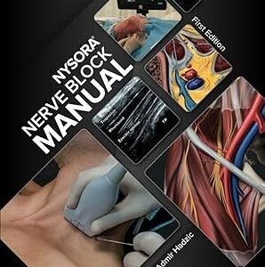 NYSORA Nerve Block Manual: First Edition First Edition